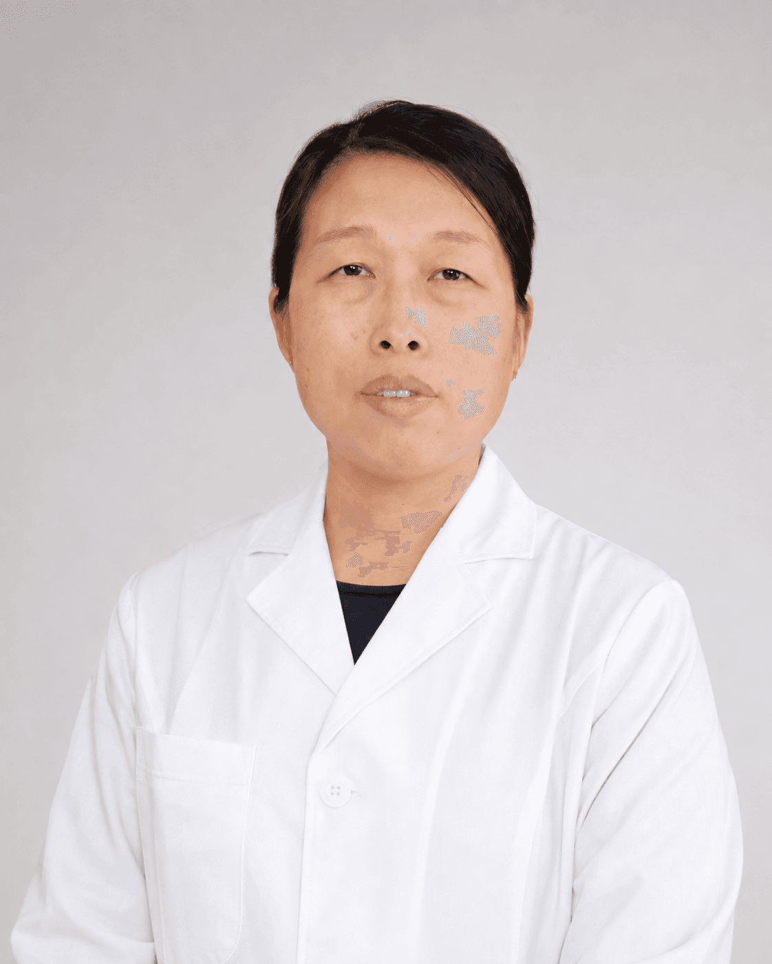 Liu Hong, MD